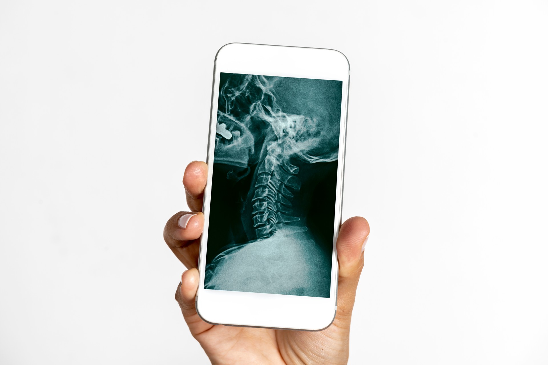 Medical X-ray With Mobile Phone